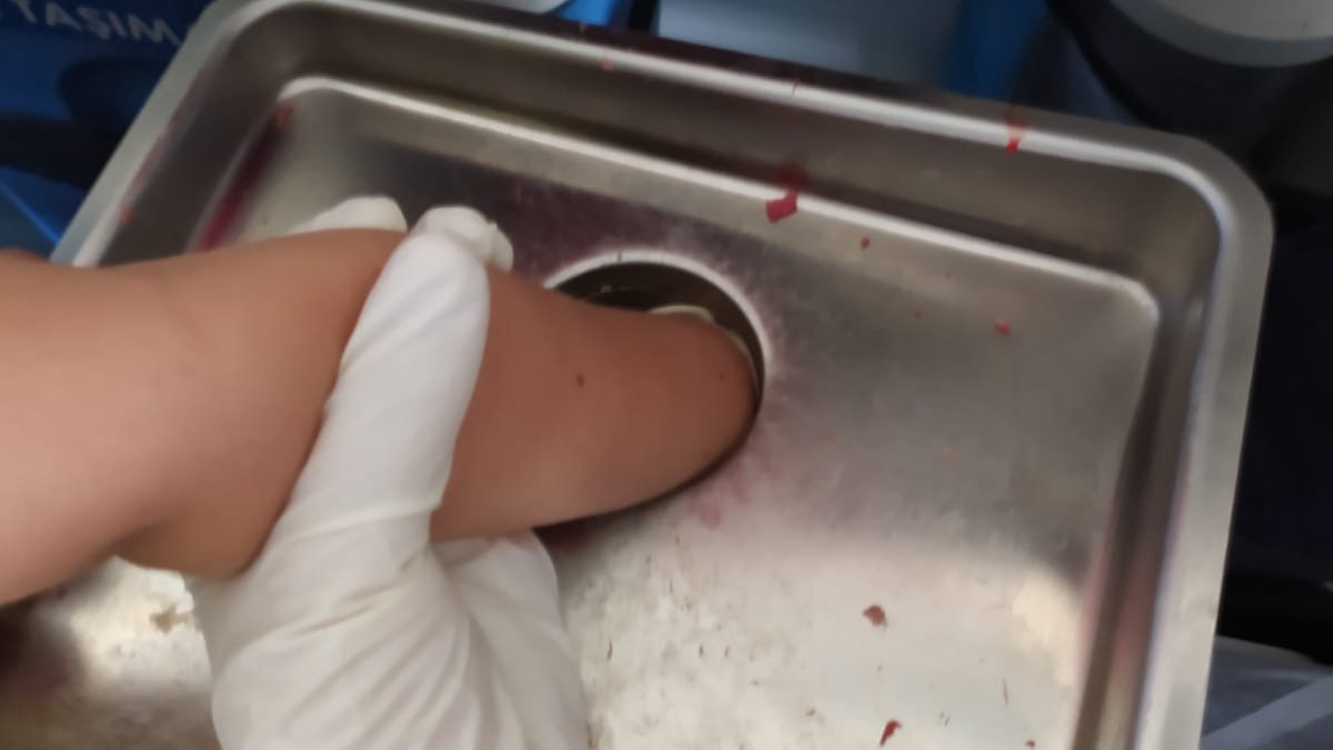 Nevşehir’de 4 yaşındaki çocuk elini kıyma makinesine kaptırdı