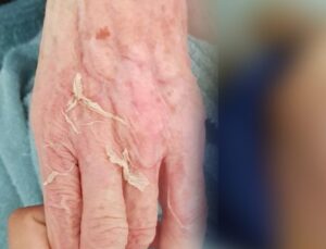 Huzurevindeki Acı Vefat Sonrası 2 Görevliye Mahpus Cezası