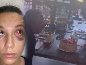 Bayana şiddetten yargılanan Ozan İtimat, Cem Yılmaz’la mum üfledi