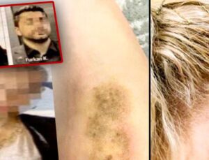 Ünlülerin avukatına taarruz: Kulağı yırtıldı saçlarından sürüklendi!
