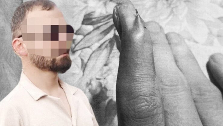 Parmağında iğneyle taburcu ettiler! Mağdur emekçiden hastaneye dev tazminat davası